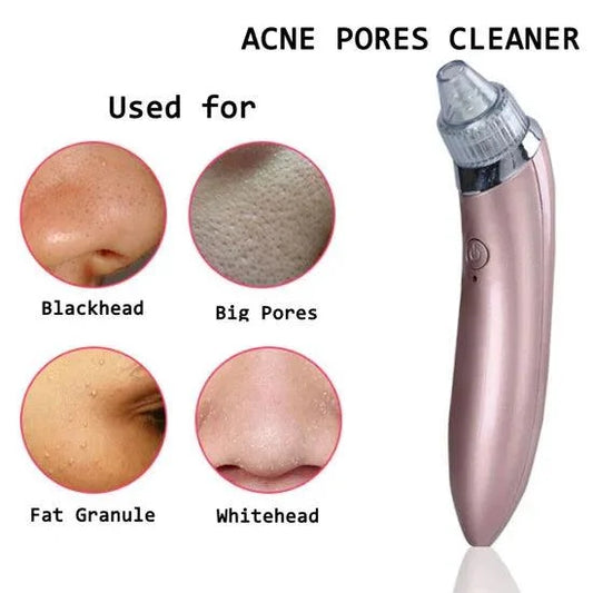 Acne pores cleaner displayed with images showing its use for skin concerns including blackheads, enlarged pores, fat granules, and whiteheads. Features a facial cleansing device designed for deep pore cleaning, removing impurities, and improving skin appearance.