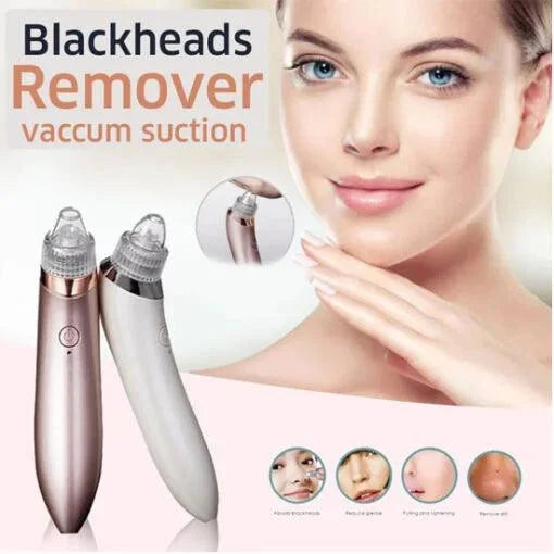 Blackheads remover vacuum suction device displayed with a woman's face showing before-and-after skin changes on a white background. Showcases a facial pore cleaning tool designed to remove blackheads, unclog pores, reduce impurities, and support smoother-looking skin.